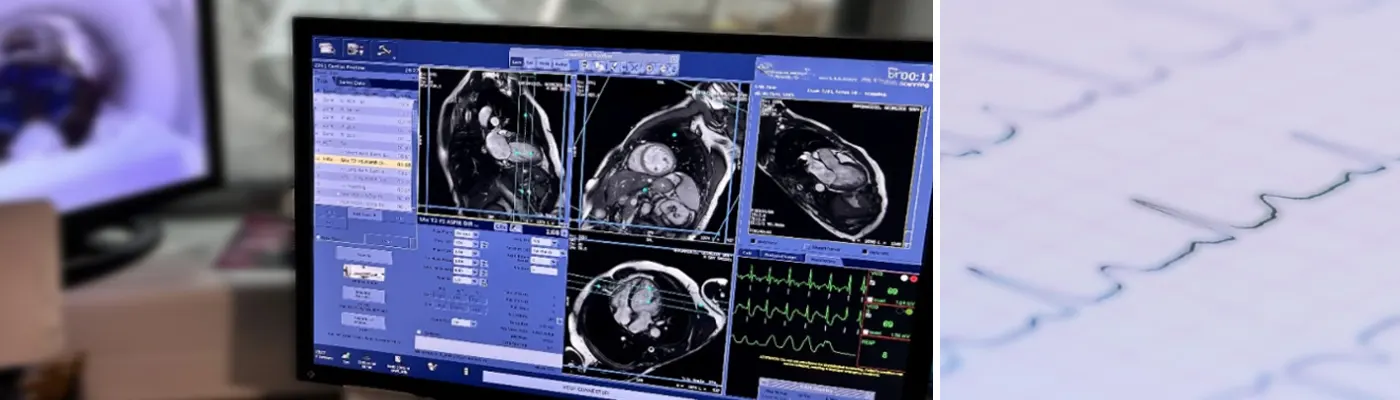 STRESS Cardiac MRI